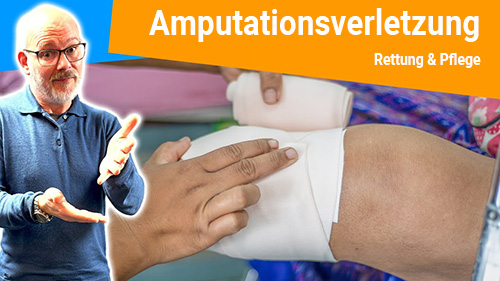 Amputationsverletzung Was ist zu tun 2 500px
